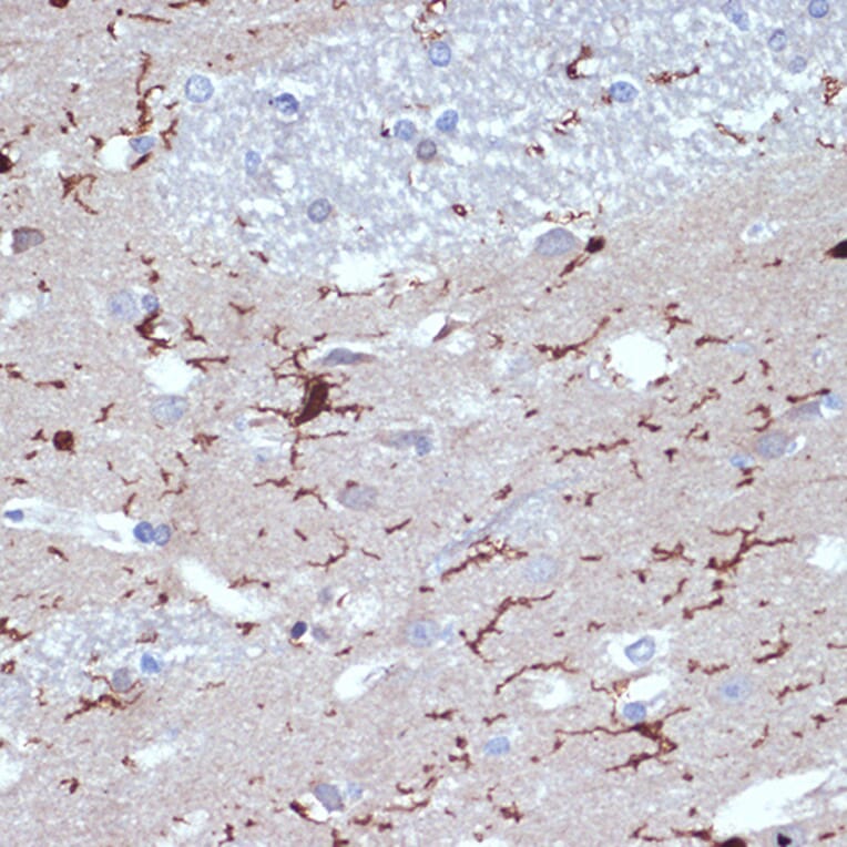 Immunohistochemistry - Anti-Iba1 Antibody [ARC2301] (A307823) - Antibodies.com