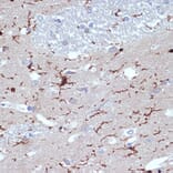 Immunohistochemistry - Anti-Iba1 Antibody [ARC2301] (A307823) - Antibodies.com
