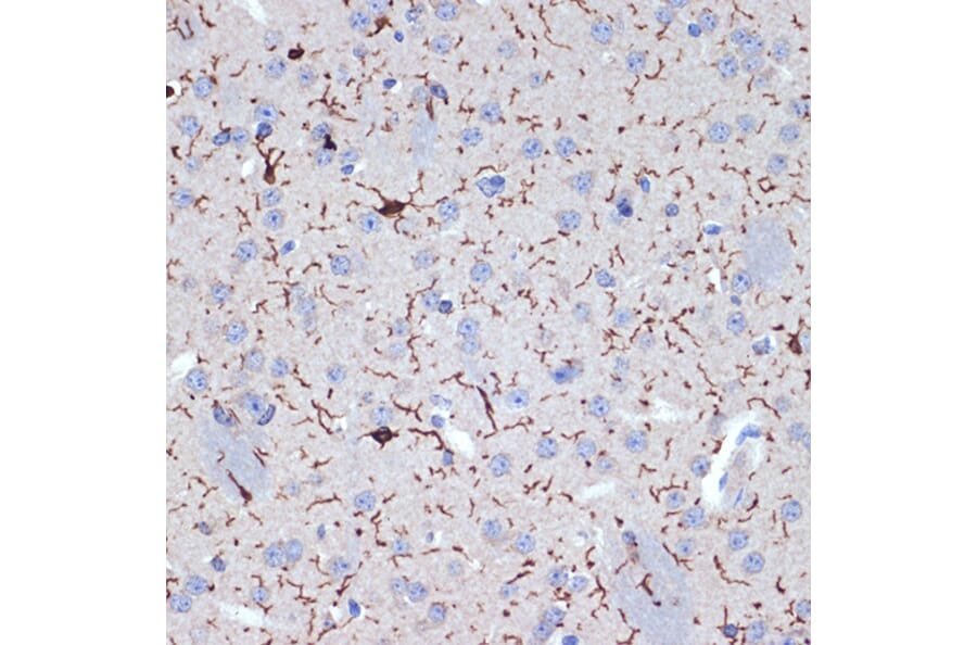 Immunohistochemistry - Anti-Iba1 Antibody [ARC2301] (A307823) - Antibodies.com