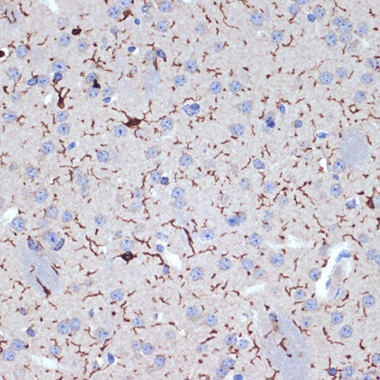 Immunohistochemistry - Anti-Iba1 Antibody [ARC2301] (A307823) - Antibodies.com