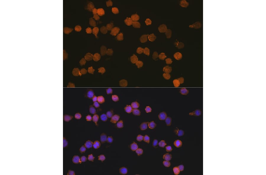 Immunofluorescence - Anti-Iba1 Antibody [ARC2301] (A307823) - Antibodies.com