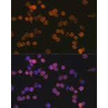 Immunofluorescence - Anti-Iba1 Antibody [ARC2301] (A307823) - Antibodies.com