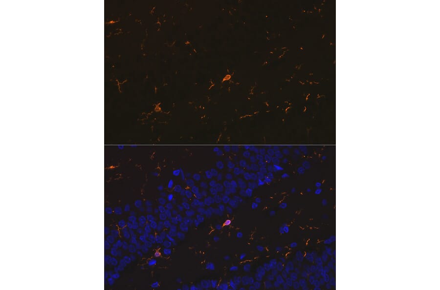 Immunofluorescence - Anti-Iba1 Antibody [ARC2301] (A307823) - Antibodies.com