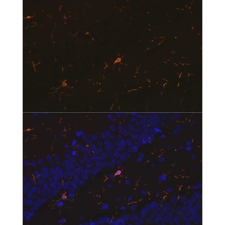 Immunofluorescence - Anti-Iba1 Antibody [ARC2301] (A307823) - Antibodies.com