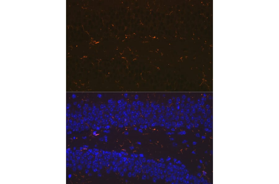 Immunofluorescence - Anti-Iba1 Antibody [ARC2301] (A307823) - Antibodies.com