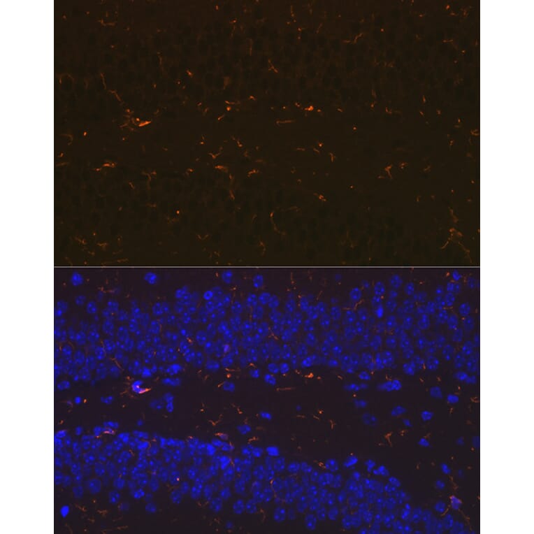 Immunofluorescence - Anti-Iba1 Antibody [ARC2301] (A307823) - Antibodies.com