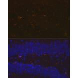 Immunofluorescence - Anti-Iba1 Antibody [ARC2301] (A307823) - Antibodies.com