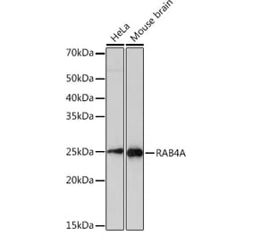 Western Blot - Anti-Rab4 Antibody [ARC2607] (A307824) - Antibodies.com