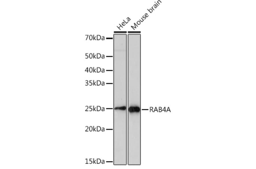 Western Blot - Anti-Rab4 Antibody [ARC2607] (A307824) - Antibodies.com