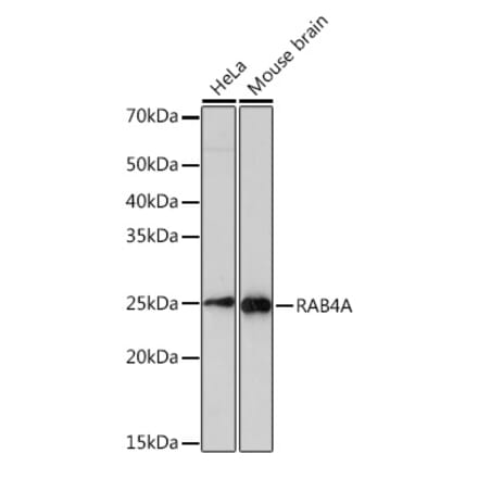 Western Blot - Anti-Rab4 Antibody [ARC2607] (A307824) - Antibodies.com