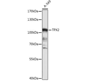 Western Blot - Anti-TPX2 Antibody (A307828) - Antibodies.com