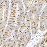 Immunohistochemistry - Anti-TPX2 Antibody (A307828) - Antibodies.com