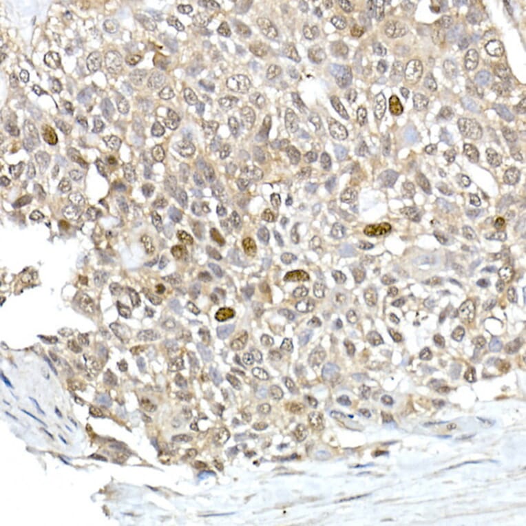 Immunohistochemistry - Anti-TPX2 Antibody (A307828) - Antibodies.com