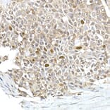 Immunohistochemistry - Anti-TPX2 Antibody (A307828) - Antibodies.com