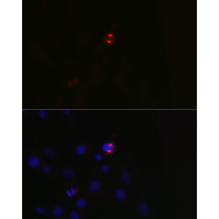 Immunofluorescence - Anti-TPX2 Antibody (A307828) - Antibodies.com