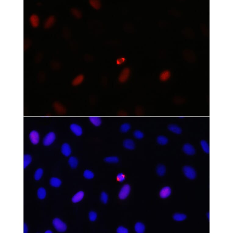 Immunofluorescence - Anti-TPX2 Antibody (A307828) - Antibodies.com