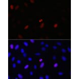 Immunofluorescence - Anti-TPX2 Antibody (A307828) - Antibodies.com