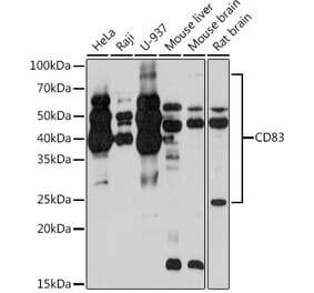 Western Blot - Anti-CD83 Antibody [ARC0935] (A307830) - Antibodies.com