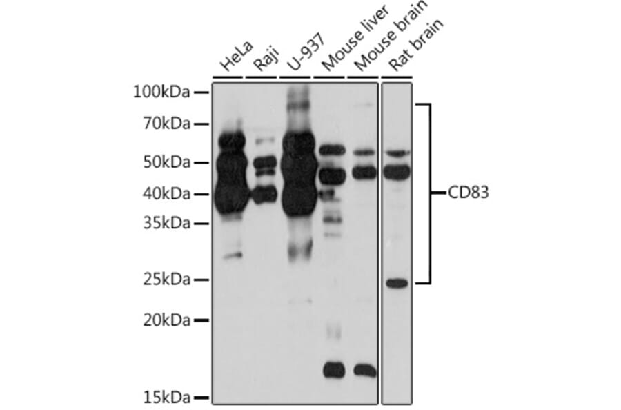 Western Blot - Anti-CD83 Antibody [ARC0935] (A307830) - Antibodies.com