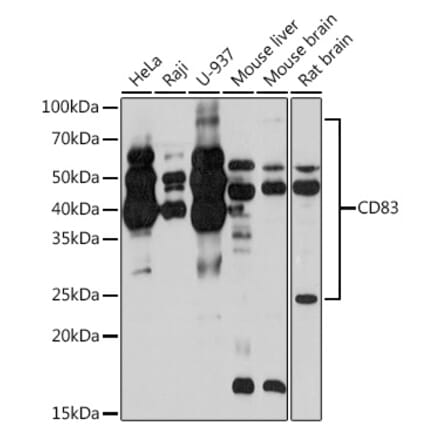 Western Blot - Anti-CD83 Antibody [ARC0935] (A307830) - Antibodies.com