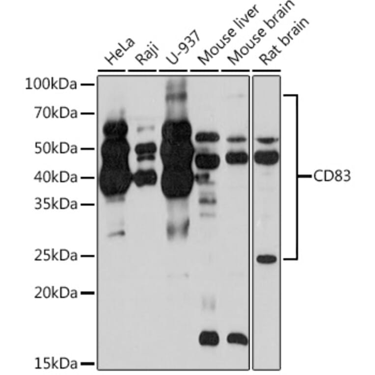 Western Blot - Anti-CD83 Antibody [ARC0935] (A307830) - Antibodies.com