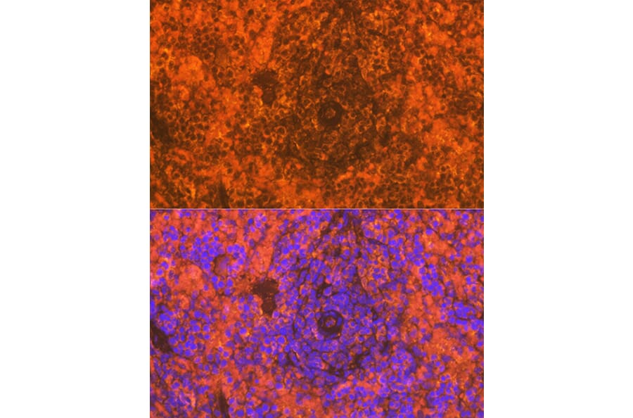 Immunofluorescence - Anti-CD83 Antibody [ARC0935] (A307830) - Antibodies.com