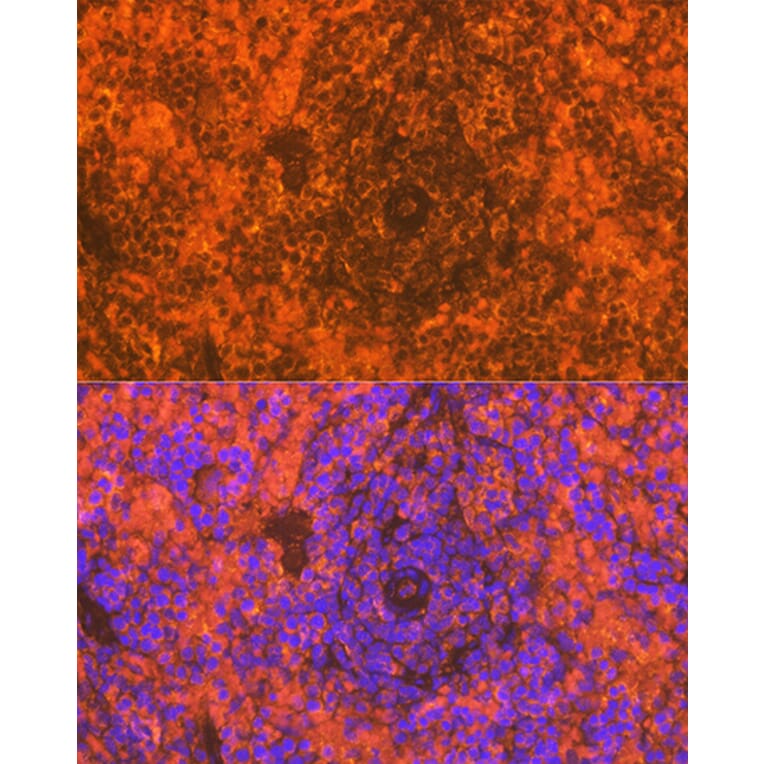 Immunofluorescence - Anti-CD83 Antibody [ARC0935] (A307830) - Antibodies.com
