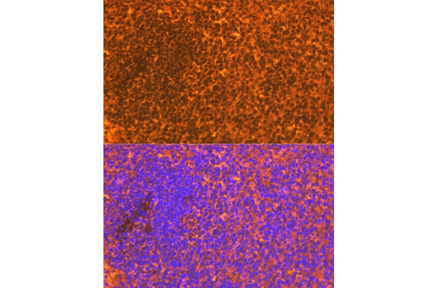 Immunofluorescence - Anti-CD83 Antibody [ARC0935] (A307830) - Antibodies.com