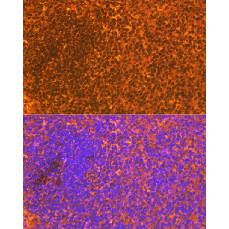 Immunofluorescence - Anti-CD83 Antibody [ARC0935] (A307830) - Antibodies.com