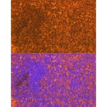 Immunofluorescence - Anti-CD83 Antibody [ARC0935] (A307830) - Antibodies.com