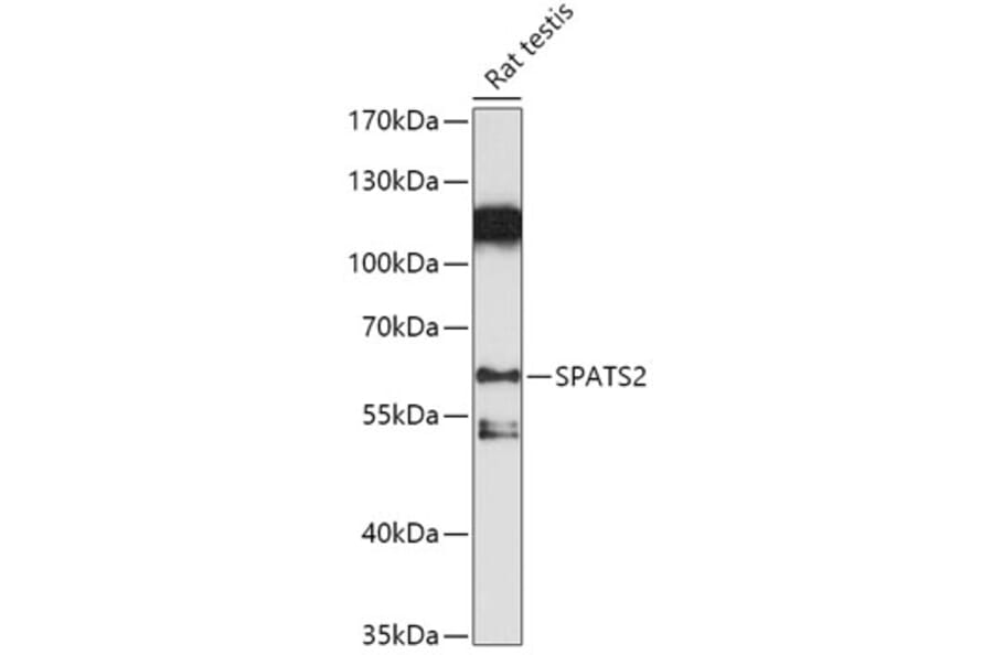 Western Blot - Anti-SPATS2 Antibody (A307831) - Antibodies.com