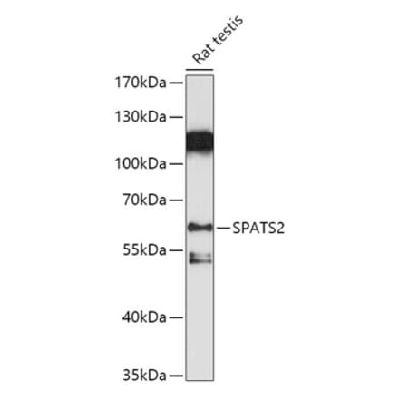 Western Blot - Anti-SPATS2 Antibody (A307831) - Antibodies.com