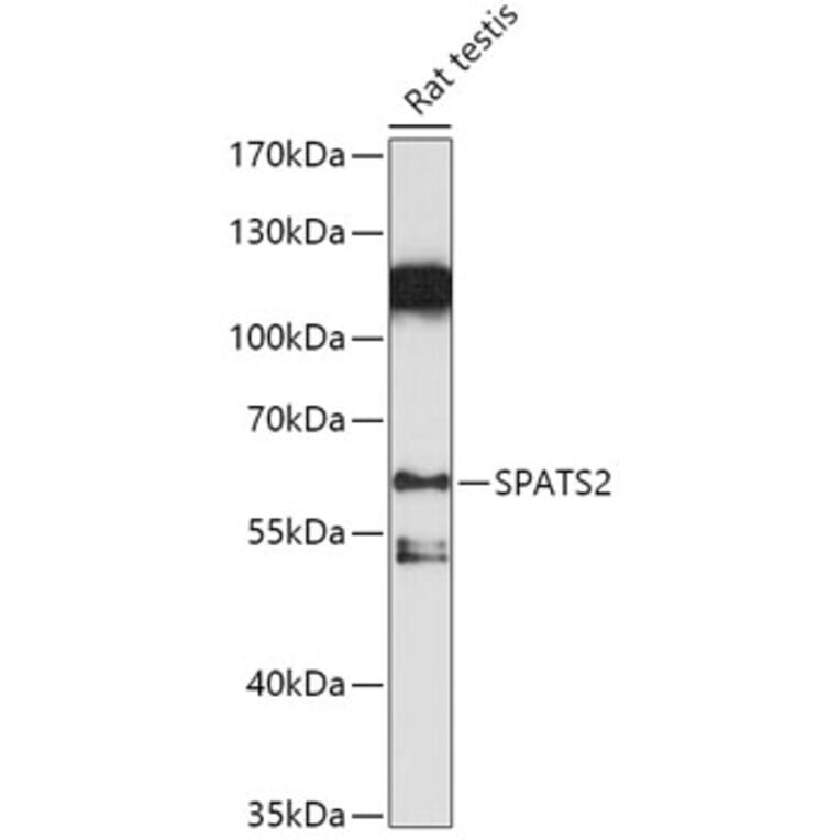 Western Blot - Anti-SPATS2 Antibody (A307831) - Antibodies.com