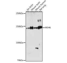 Western Blot - Anti-MSH6 Antibody (A307834) - Antibodies.com