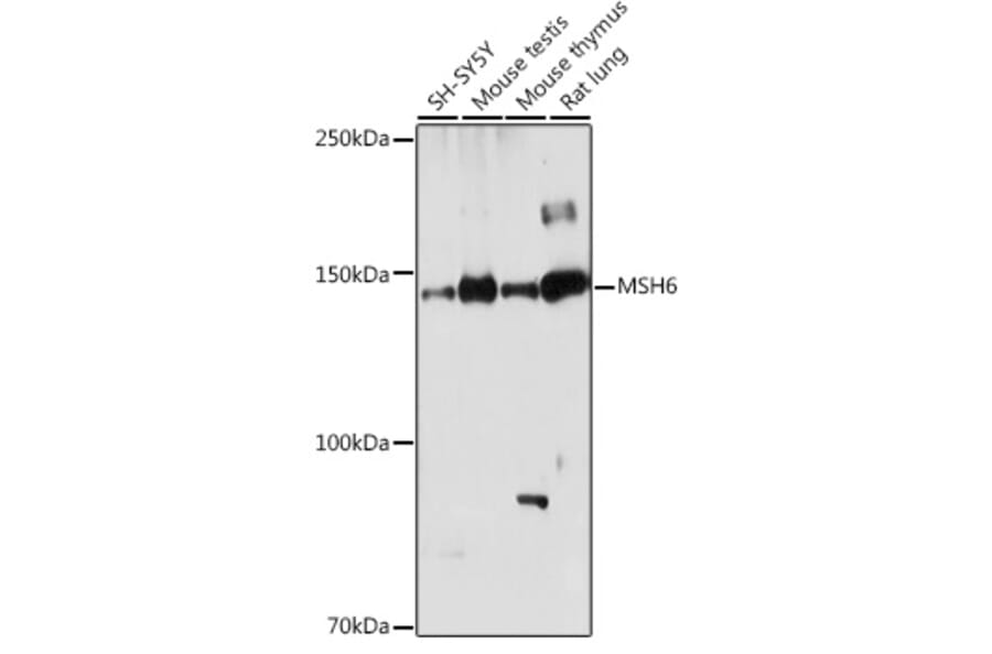 Western Blot - Anti-MSH6 Antibody (A307834) - Antibodies.com