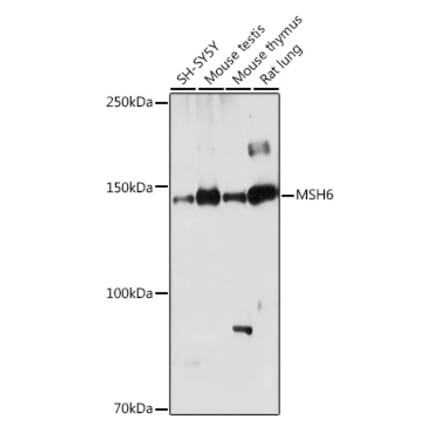 Western Blot - Anti-MSH6 Antibody (A307834) - Antibodies.com