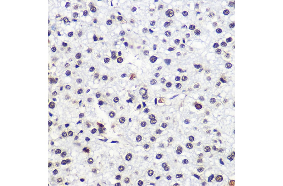 Immunohistochemistry - Anti-MSH6 Antibody (A307834) - Antibodies.com