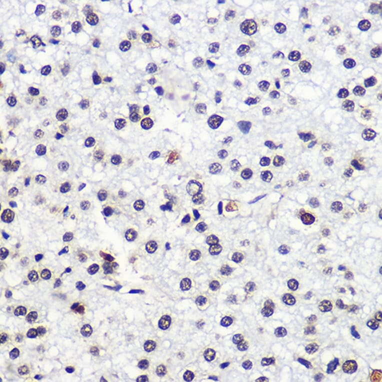 Immunohistochemistry - Anti-MSH6 Antibody (A307834) - Antibodies.com