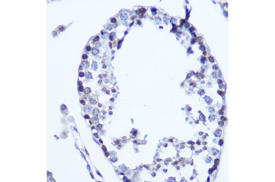 Immunohistochemistry - Anti-MSH6 Antibody (A307834) - Antibodies.com