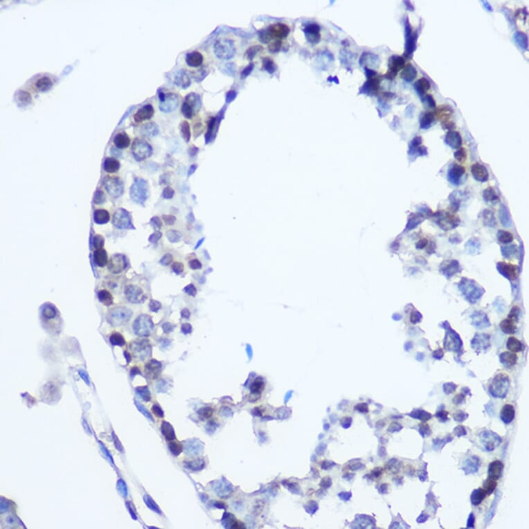 Immunohistochemistry - Anti-MSH6 Antibody (A307834) - Antibodies.com