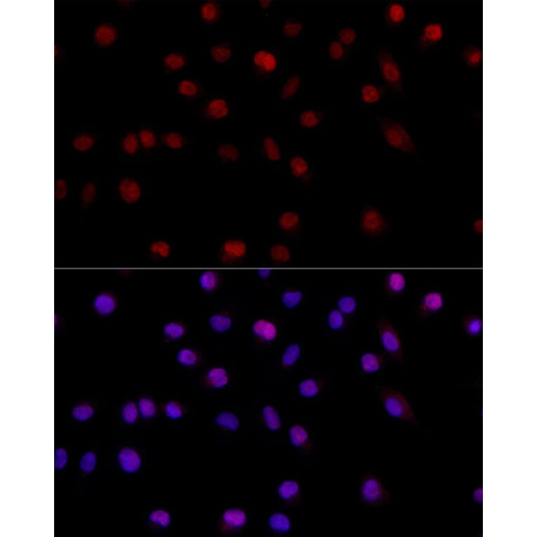 Immunofluorescence - Anti-MSH6 Antibody (A307834) - Antibodies.com