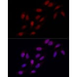 Immunofluorescence - Anti-MSH6 Antibody (A307834) - Antibodies.com