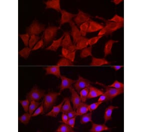 Immunofluorescence - Anti-Smg1 Antibody (A307835) - Antibodies.com