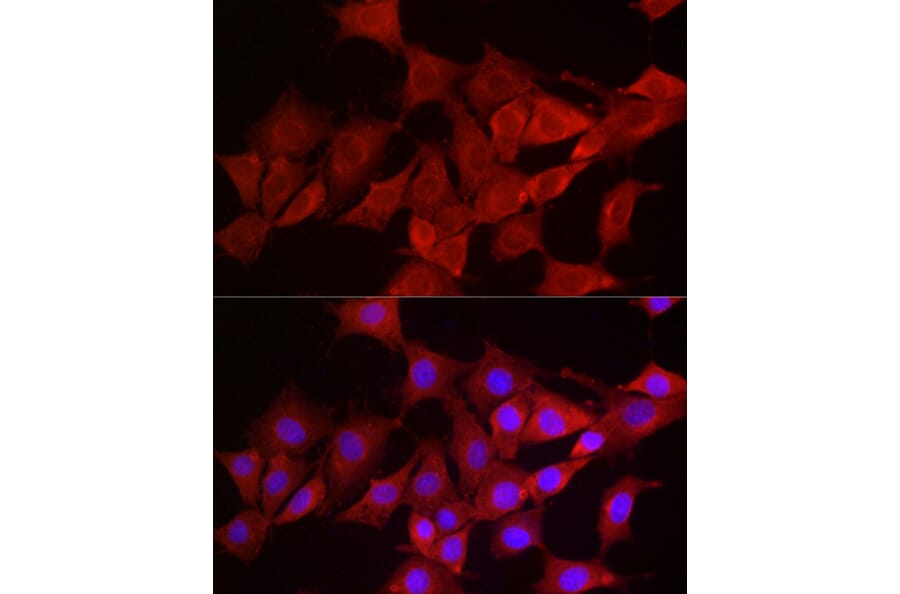 Immunofluorescence - Anti-Smg1 Antibody (A307835) - Antibodies.com