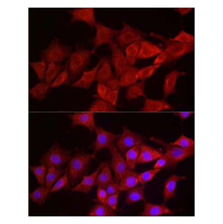 Immunofluorescence - Anti-Smg1 Antibody (A307835) - Antibodies.com