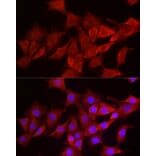 Immunofluorescence - Anti-Smg1 Antibody (A307835) - Antibodies.com