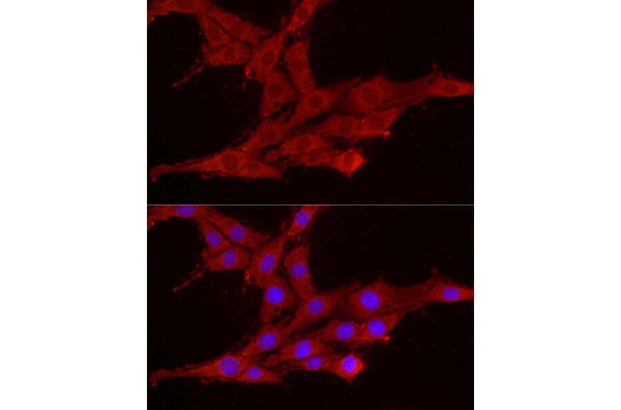 Immunofluorescence - Anti-Smg1 Antibody (A307835) - Antibodies.com