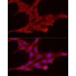 Immunofluorescence - Anti-Smg1 Antibody (A307835) - Antibodies.com