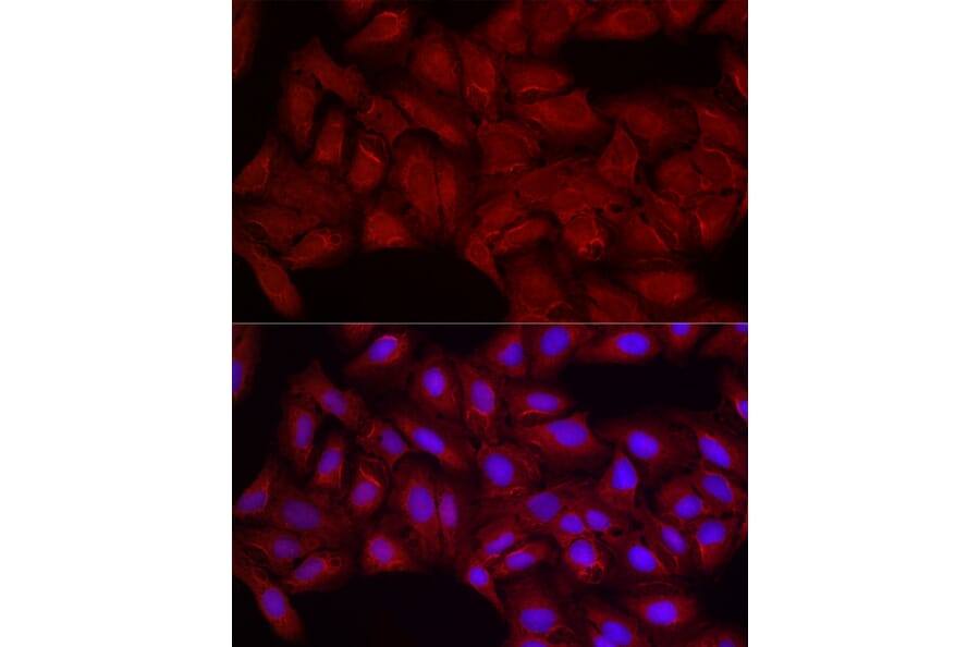 Immunofluorescence - Anti-Smg1 Antibody (A307835) - Antibodies.com