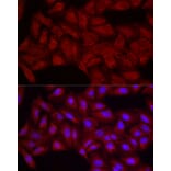 Immunofluorescence - Anti-Smg1 Antibody (A307835) - Antibodies.com